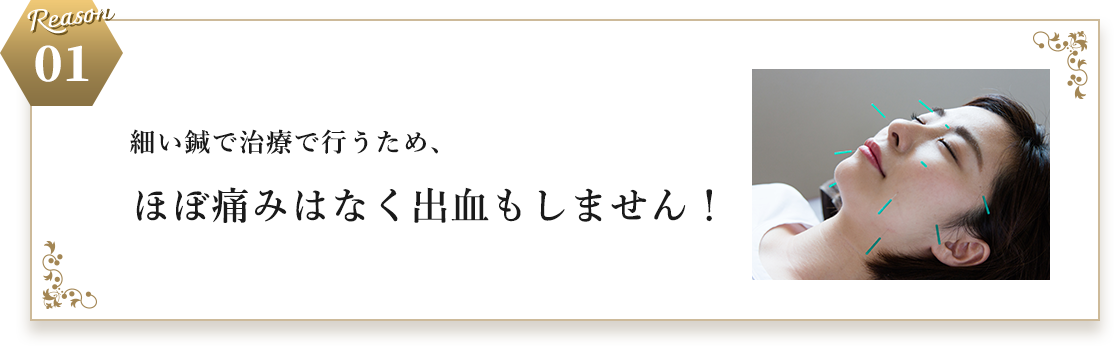 Reason 01 細い鍼で治療で行うため、​ほぼ痛みはなく出血もしません！​